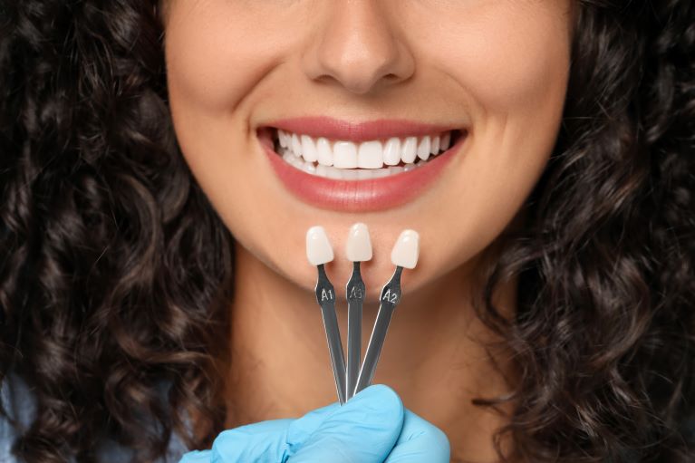 a lady is testing porcelain veneers for the suitable one